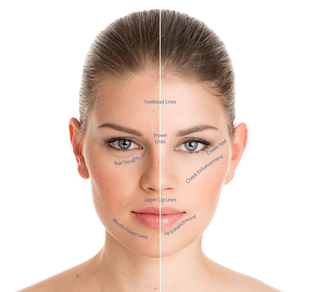 woman with face outlined for cosmetic surgery concept