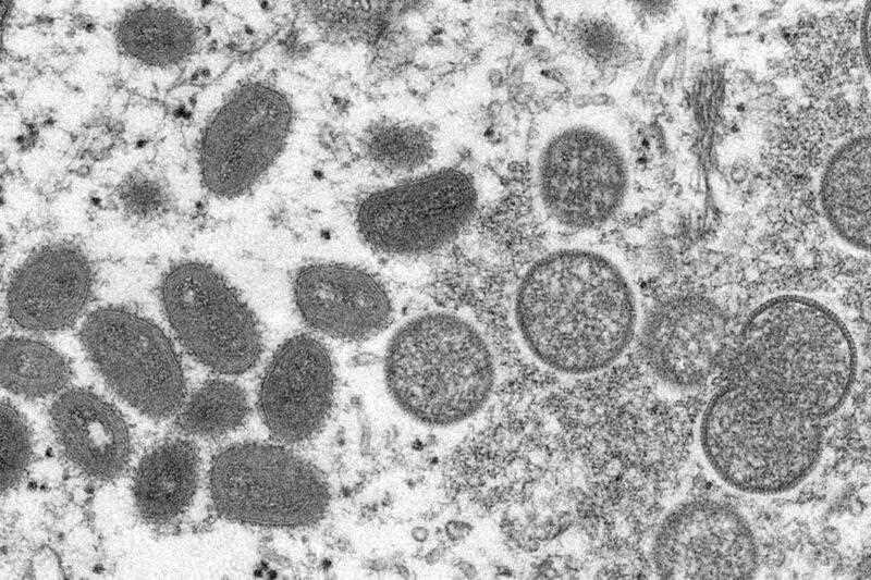 This 2003 electron microscope image made available by the Centers for Disease Control and Prevention shows mature, oval-shaped monkeypox virions, left, and spherical immature virions, right, obtained from a sample of human skin